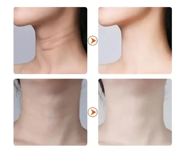 Massageador DermaLift – Rejuvenescimento Facial com Vibração e Calor